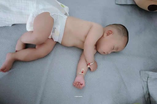 赤壁宝宝褶皱处擦粉还是油